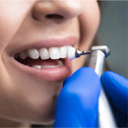 Close-up of woman’s smile during professional dental cleaning with polishing tool.