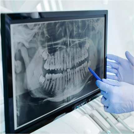 Gloved hands pointing at a digital panoramic dental X-ray on a monitor.