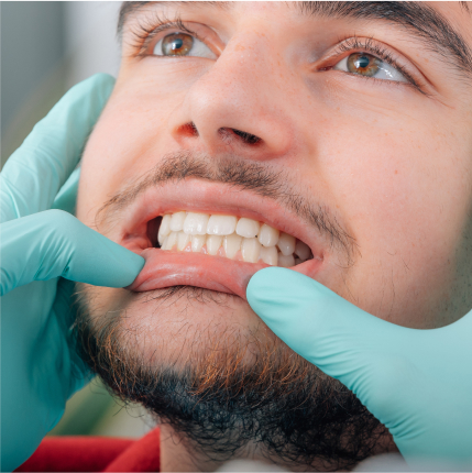Gum Grafting