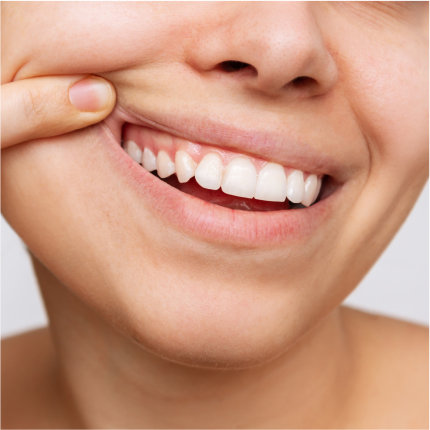 Close-up of a person pulling back their lip to show healthy gums and teeth, highlighting gum care.