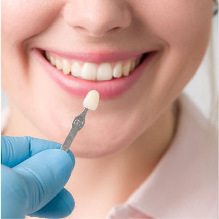 Porcelain Dental Veneers in Coral Gables, FL