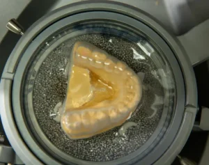 teeth mold creating a clear aligner