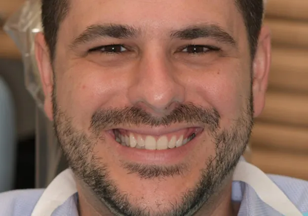 After Clear Aligner Treatment